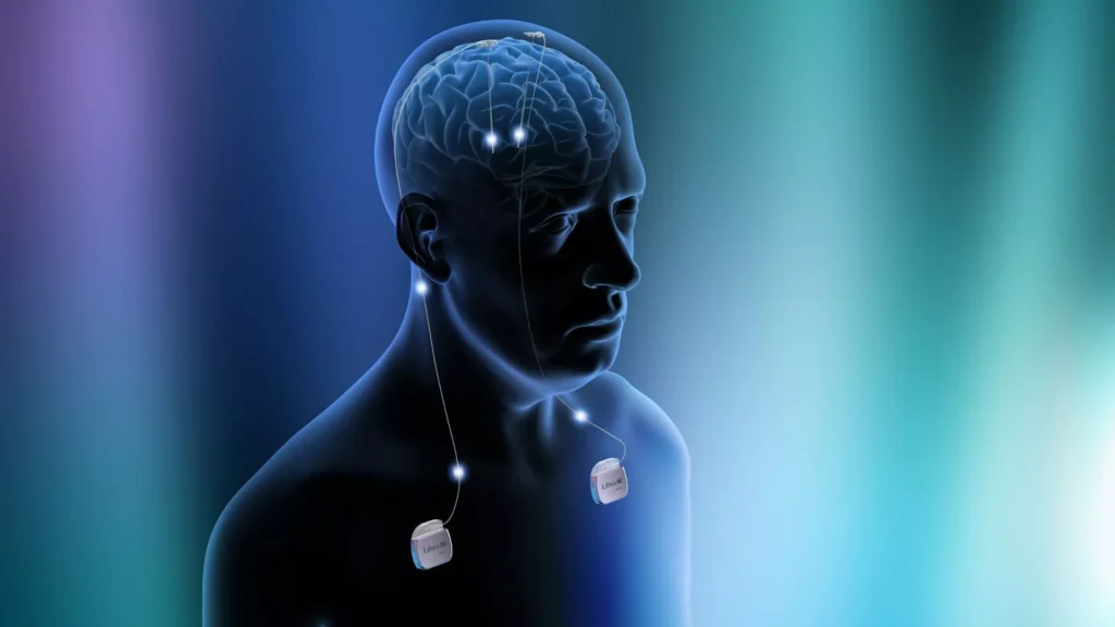 parkinson