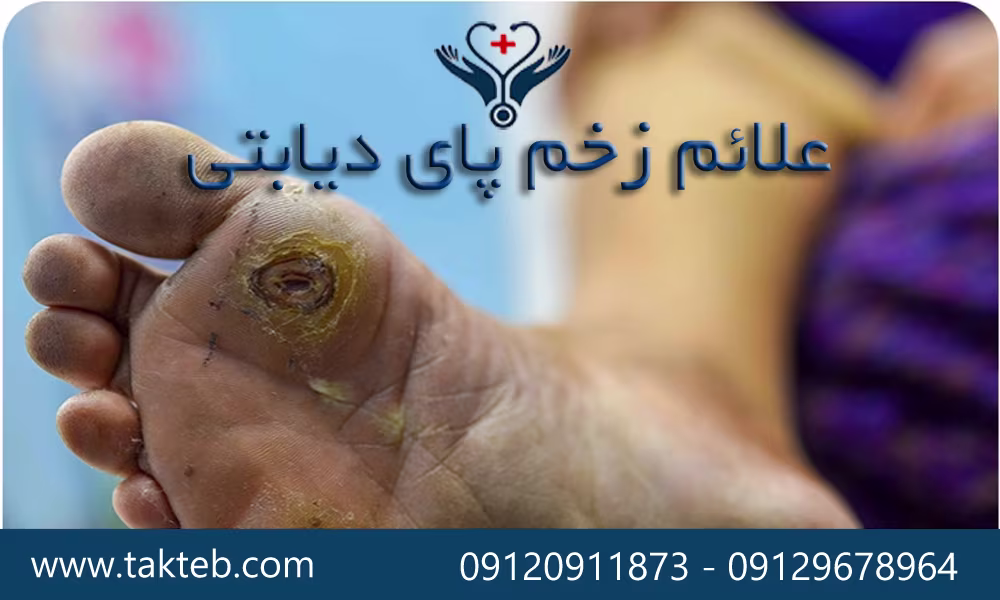 علائم زخم پای دیابتی
