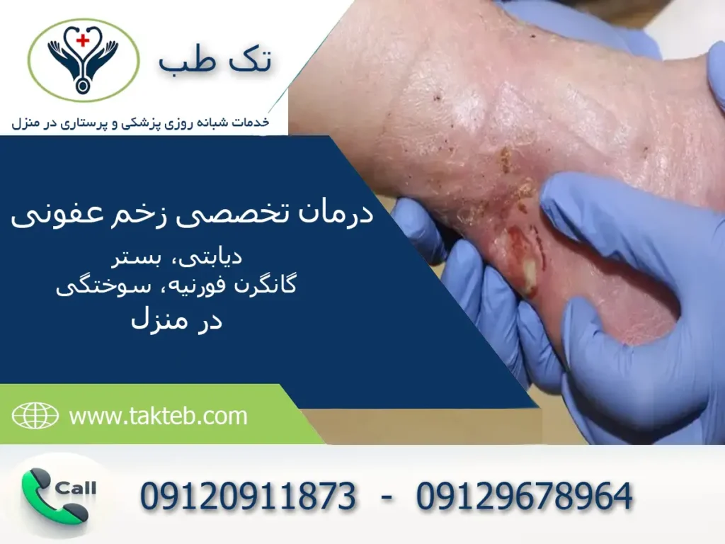 درمان زخم عفونی در منزل تهران