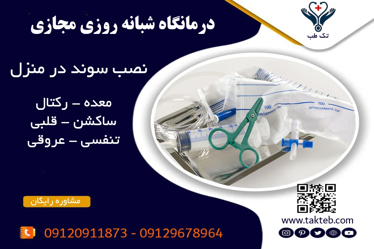 نصب سوند در منزل تهران با پرستاران مجرب تک طب