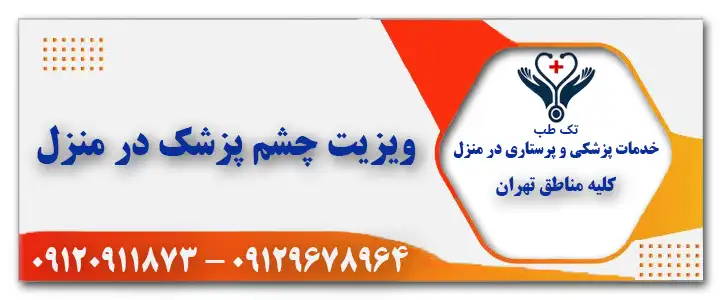 ویزیت چشم پزشک در منزل تهران
