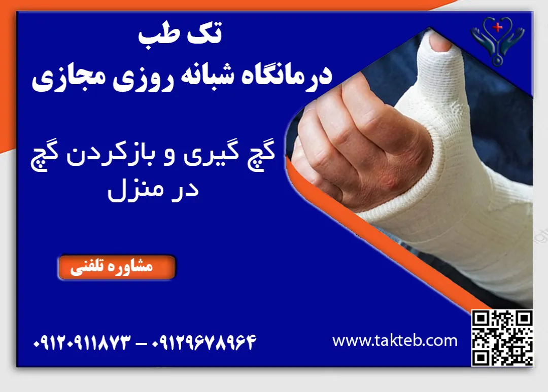 گچ گیری در منزل تهران، باز کردن گچ در منزل