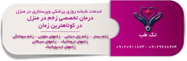 درمان زخم سوختگی در منزل تهران
