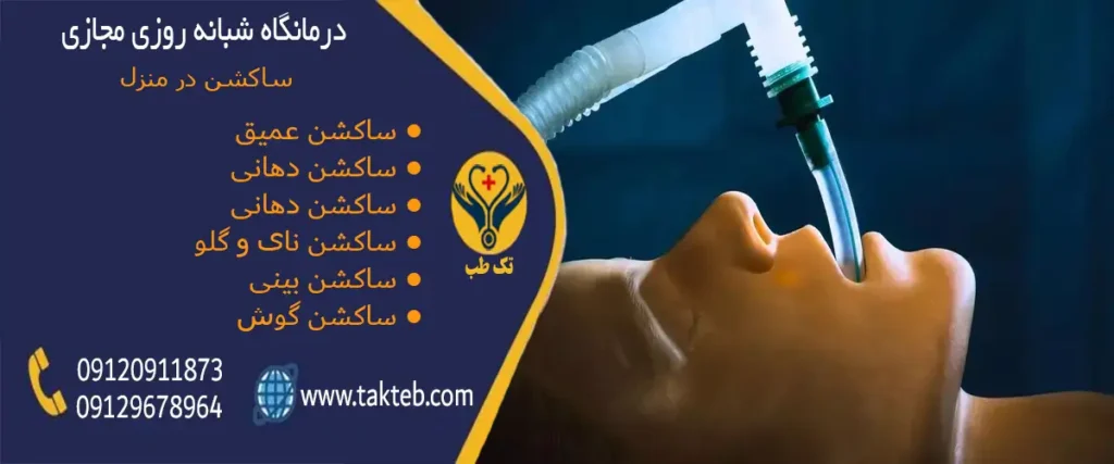 ساکشن در منزل تهران