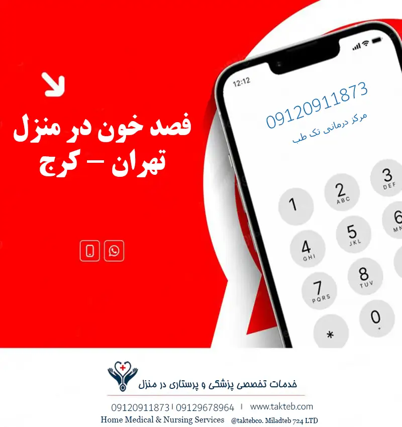 فصد خون در منزل