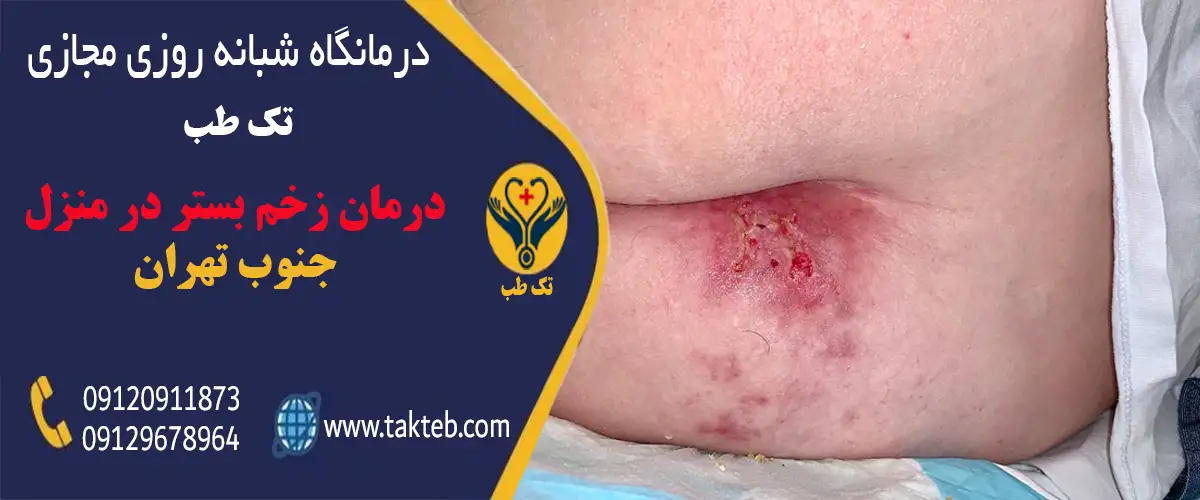 درمان زخم بستر در منزل جنوب تهران توسط پرستاران مرکز درمانی تک طب