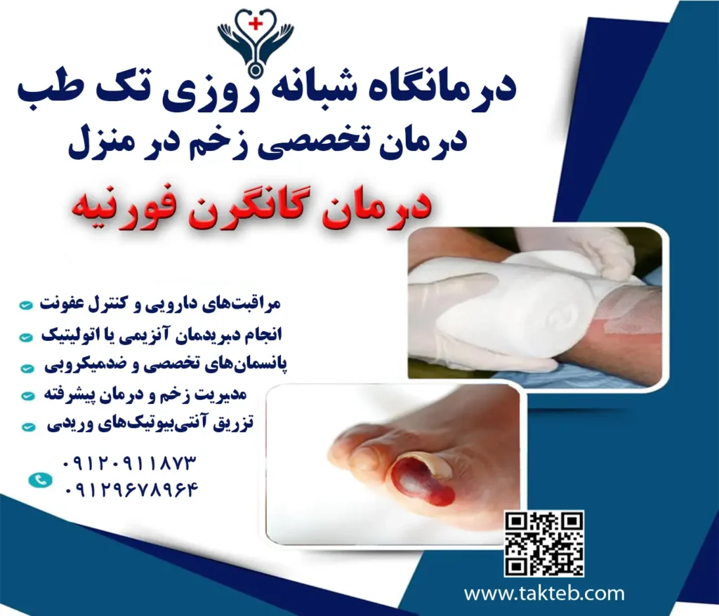 درمان گانگرن فورنیه در منزل تهران