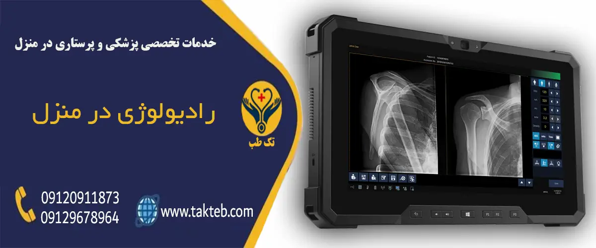 رادیولوژی در منزل تهران 1