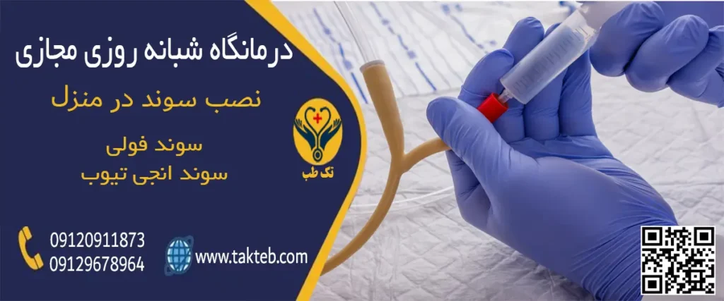 نصب سوند در منزل تهران