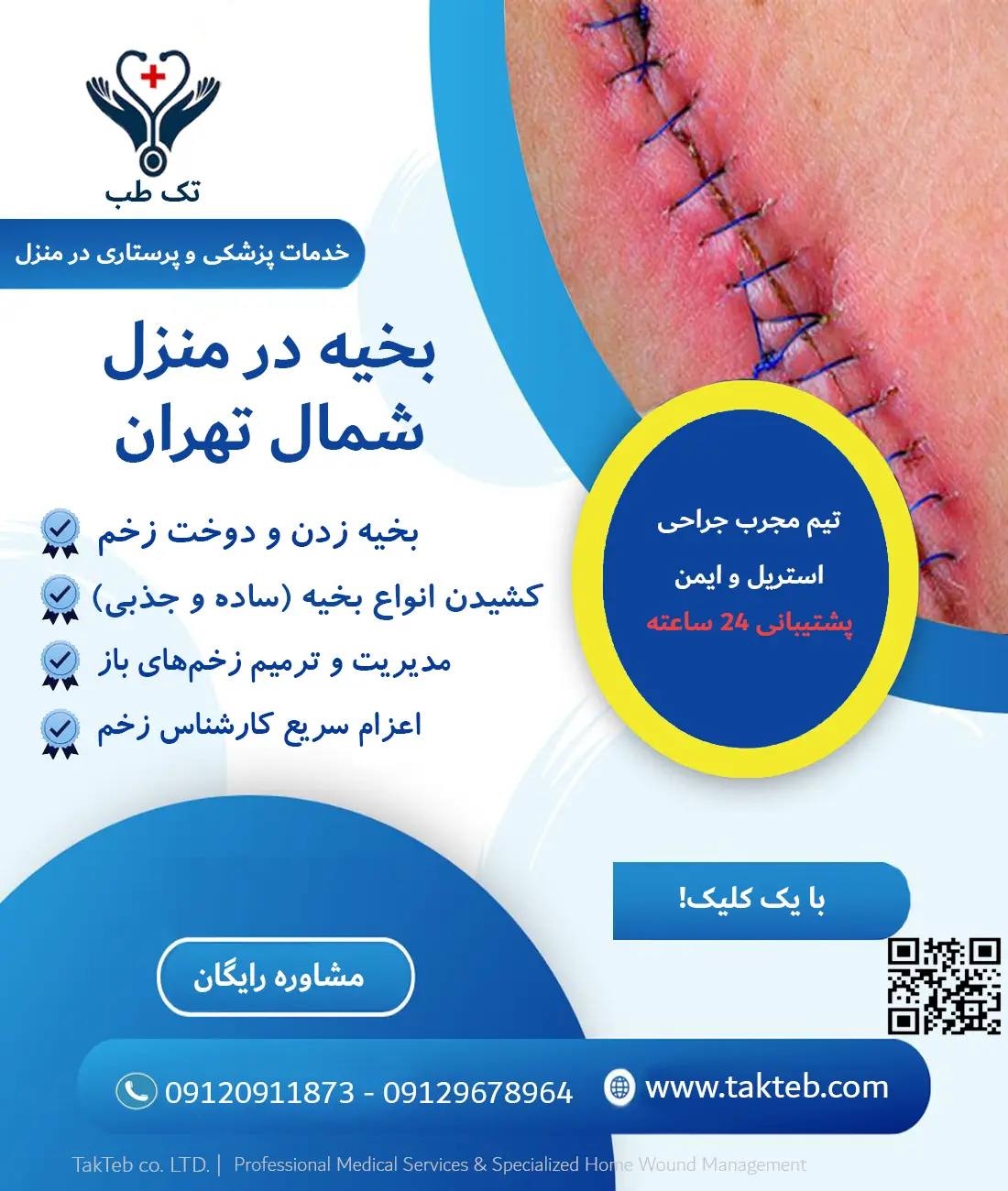 بخیه در منزل شمال تهران، زدن و کشیدن بخیه در منزل شمال تهران توسط پرستار تک طب